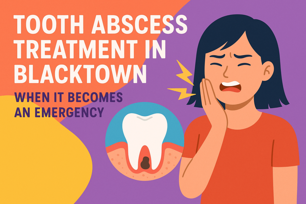 Tooth Abscess Treatment in Blacktown: When It Becomes an Emergency
