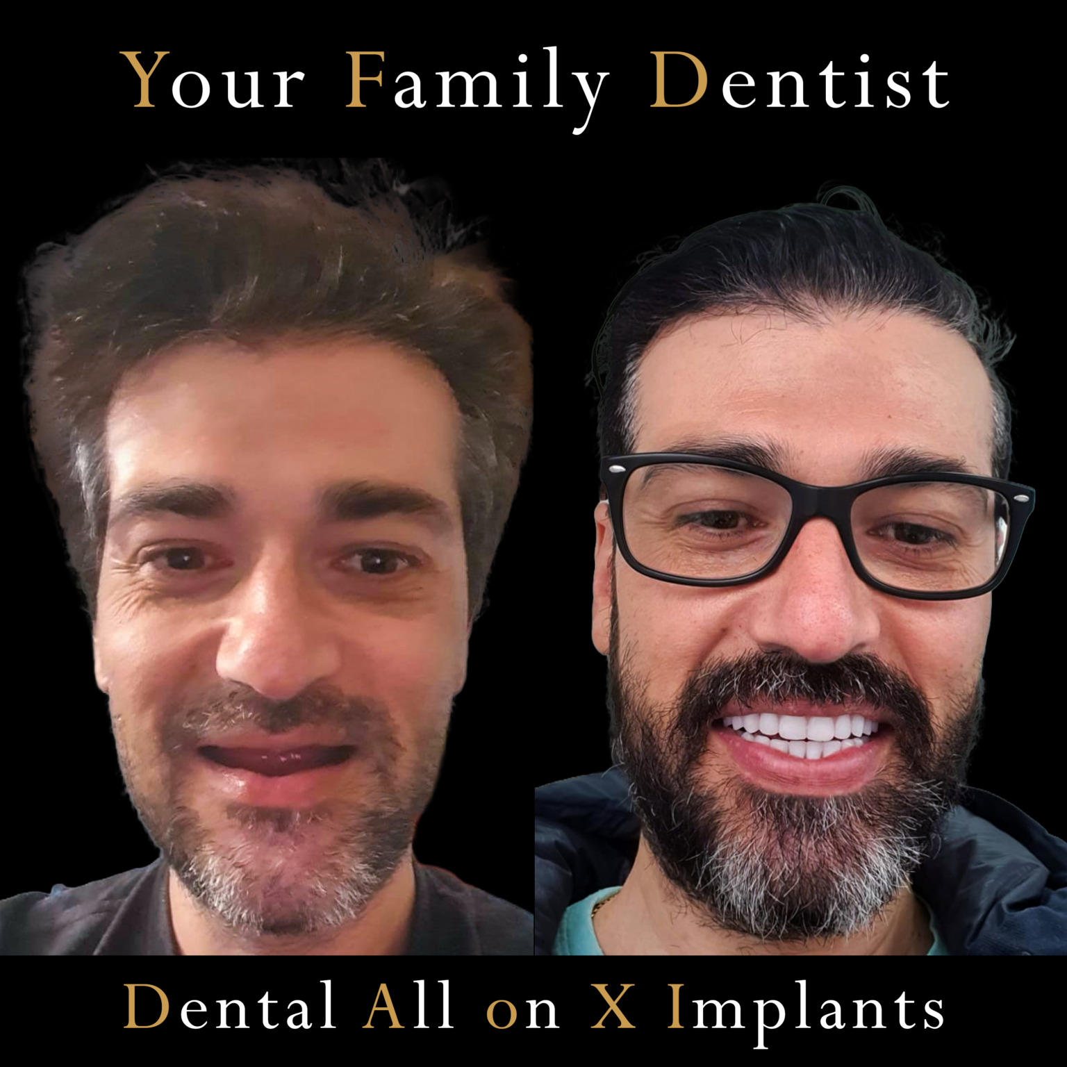 Patient Before and After Smile Transformation