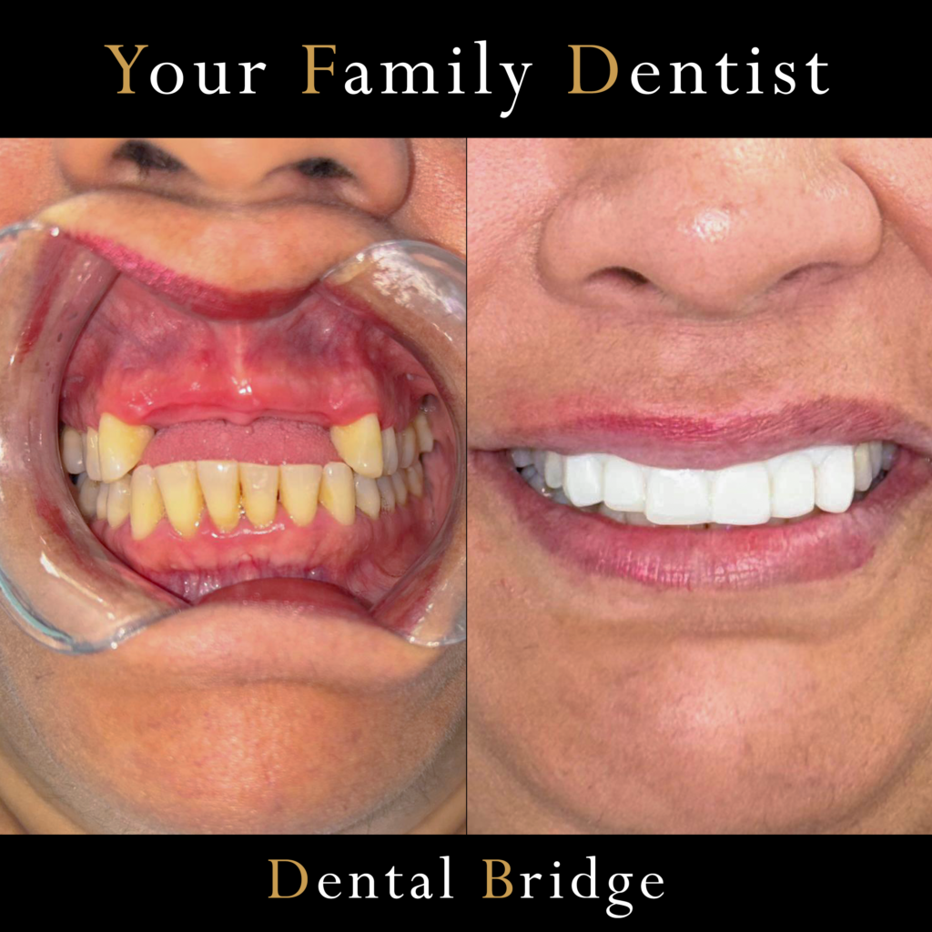 Unaloto Apolosio Before and After